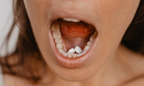 How to take misoprostol sublingually - under the tongue